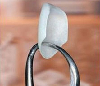 Photo of the tip of dental forceps holding a single porcelain veneer; for information on Lumineers from Beverly Hills cosmetic dentist Brian LeSage DDS.